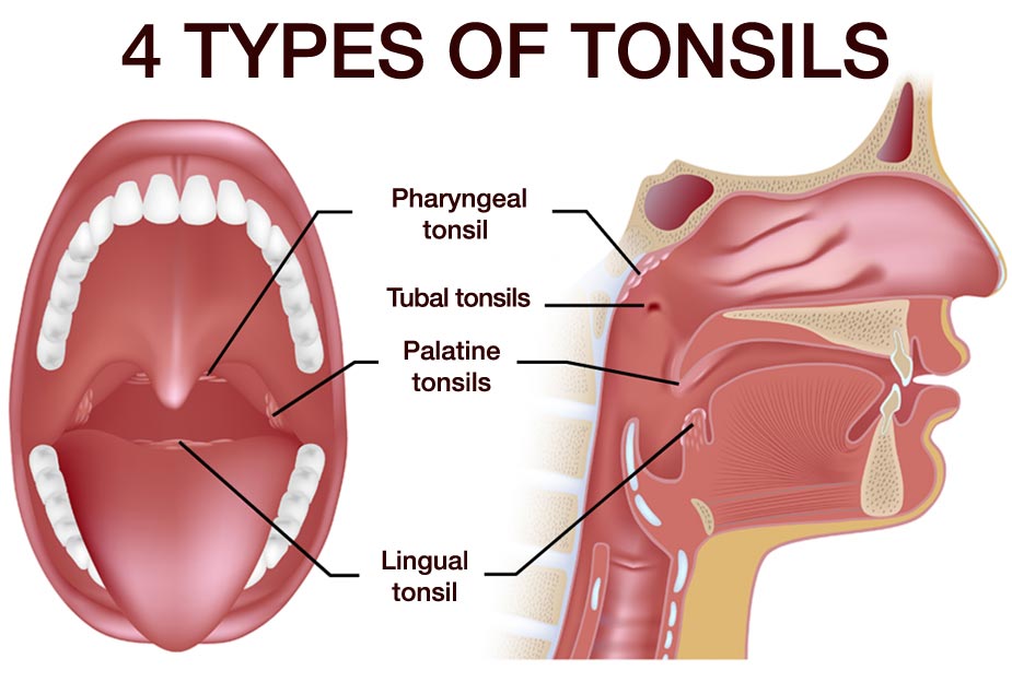 4 types of tonsils, pharyngeal, tubular, palatal, lingual