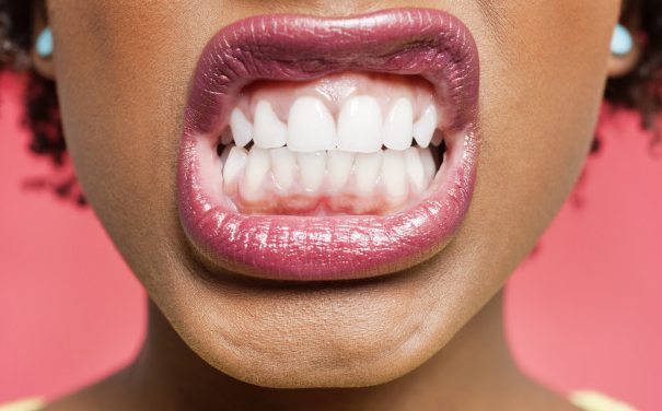 What might cause you to grind your teeth?