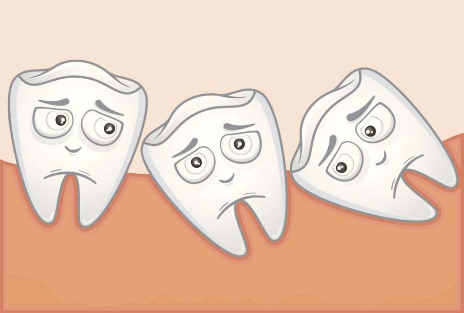 Why are wisdom teeth called “wisdom teeth”?