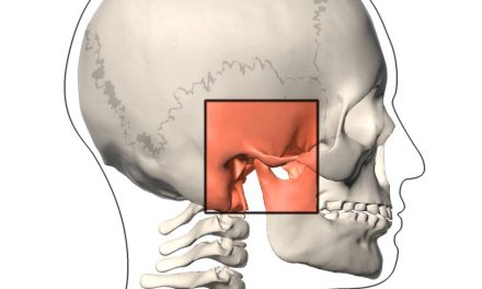 TMD (Pain and Cracking of the Jaw)